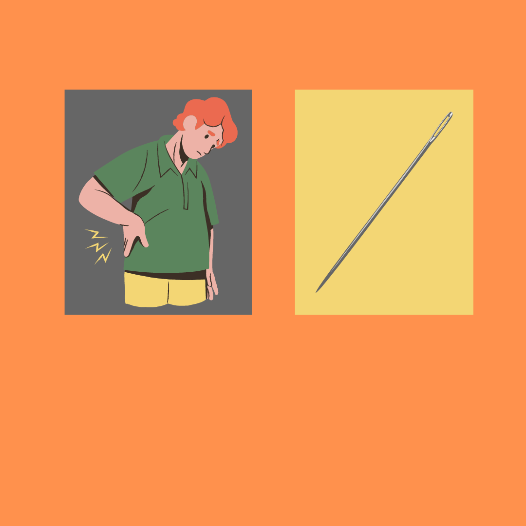 Dry Needling for Hip Pain?! sapiens movēs